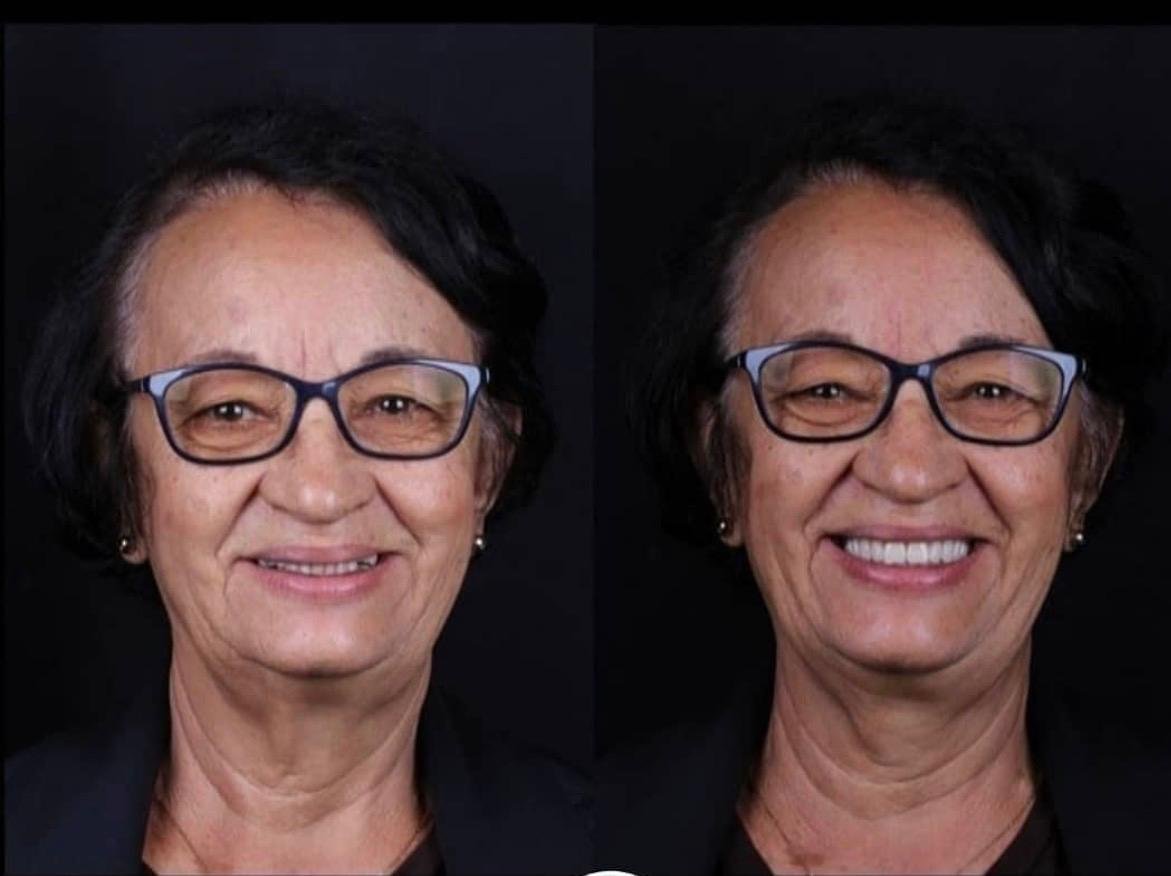 Paciente da Figueiró Odontologia